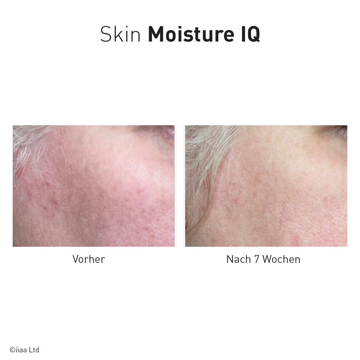 Advanced Nutrition Programme - Skin Moisture IQ - Nahrungsergänzung - Advanced Nutrition Programme - Care Concept Onlineshop - Vertrieb für Premium Wirkstoffkosmetik