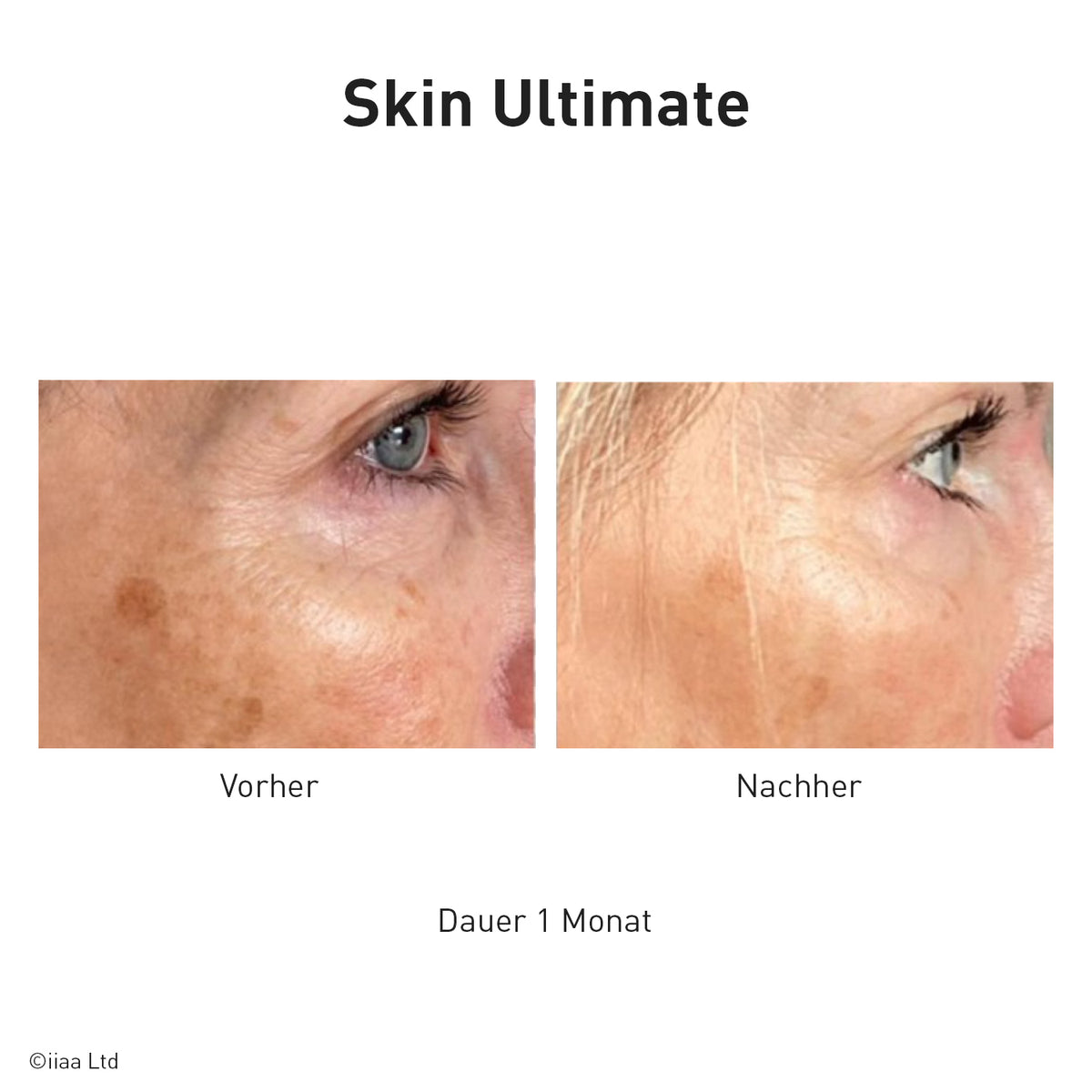 Advanced Nutrition Programme - Skin Ultimate - Nahrungsergänzung - Advanced Nutrition Programme - Care Concept Onlineshop - Vertrieb für Premium Wirkstoffkosmetik