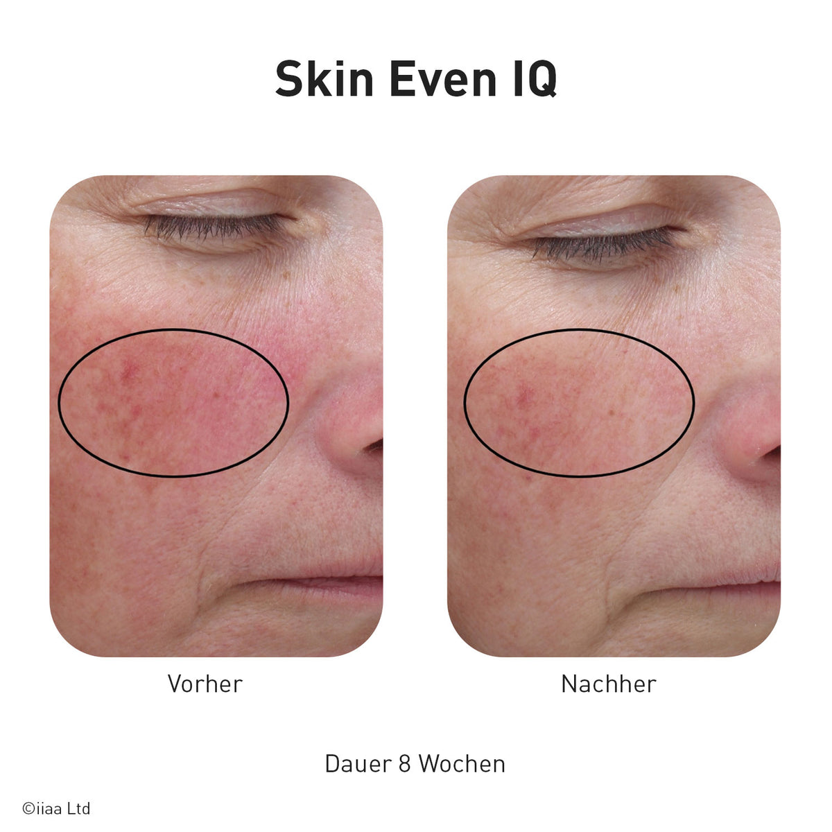 Advanced Nutrition Programme - Skin Even IQ - Nahrungsergänzung - Advanced Nutrition Programme - Care Concept Onlineshop - Vertrieb für Premium Wirkstoffkosmetik