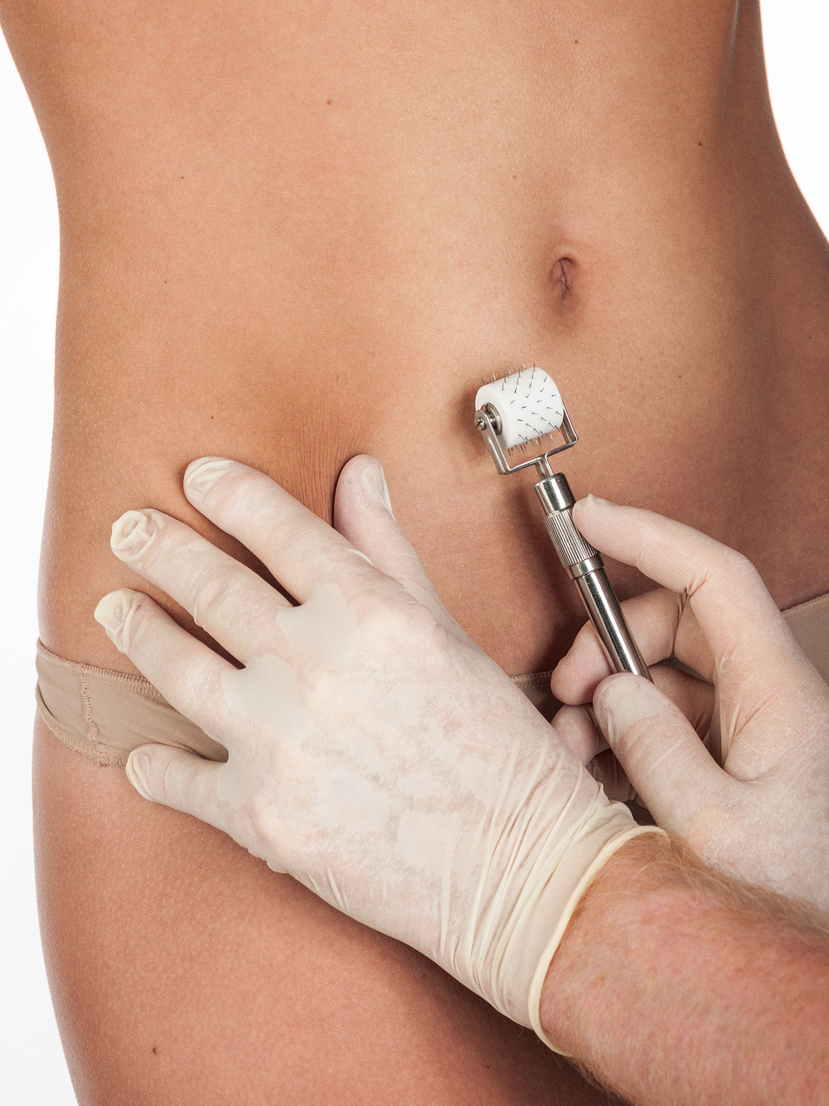 Care Concept Onlineshop - Surgical Needling