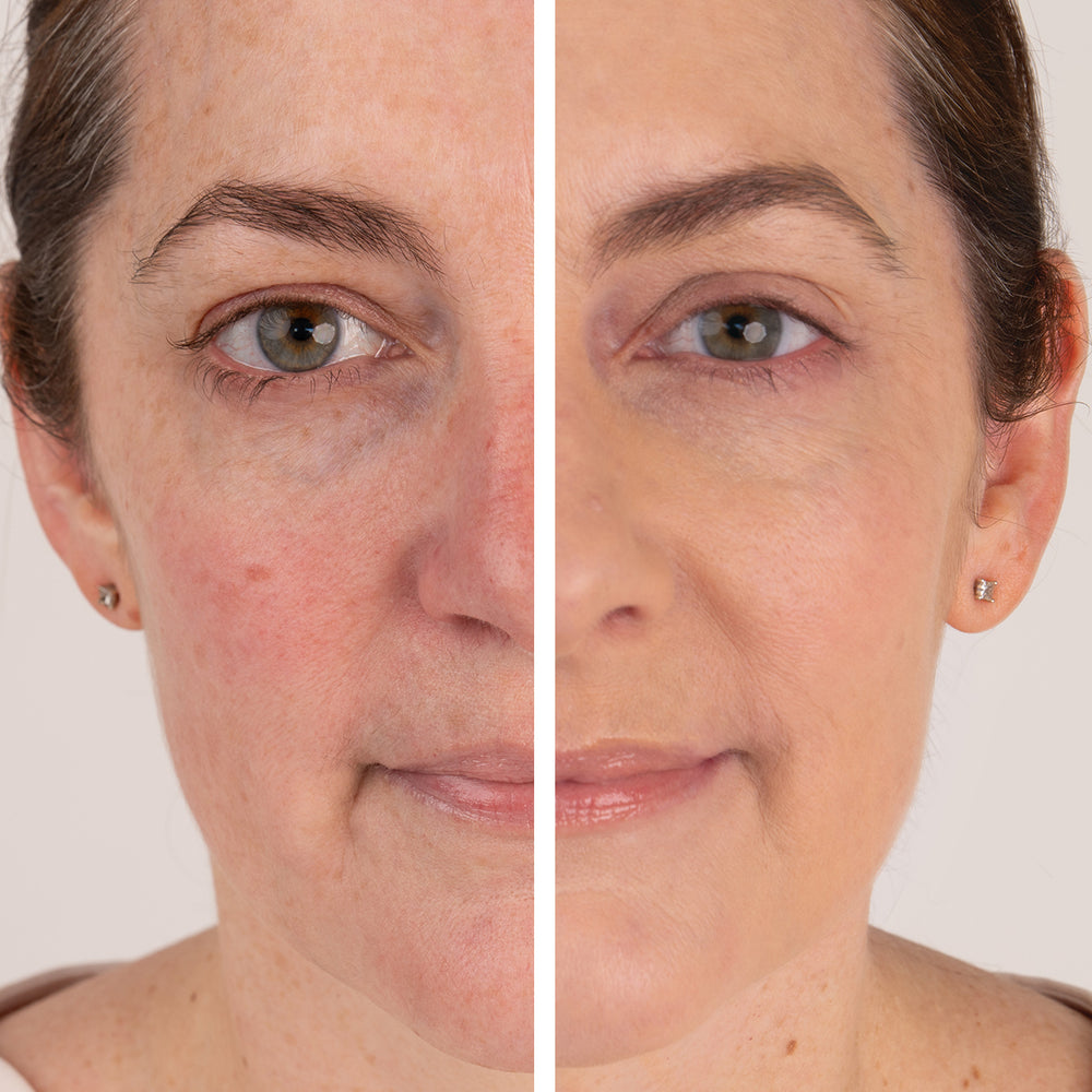Care Concept Onlineshop - jane iredale Vorher Nachher Bild Elisa