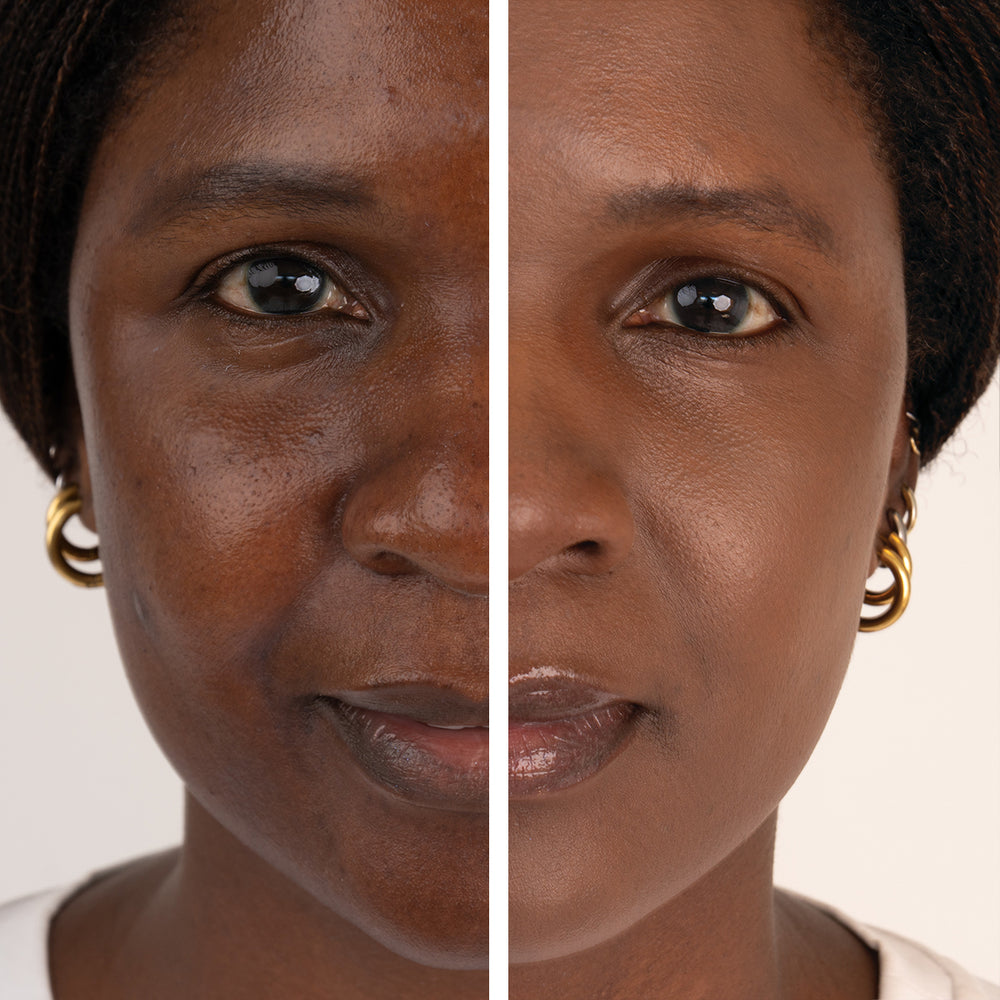 Care Concept Onlineshop - jane iredale Vorher Nachher Bild Pauline